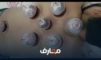 تأثير الحجامة على الرئتين