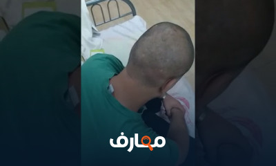 طريقة حجامة لتخفيف الصداع
