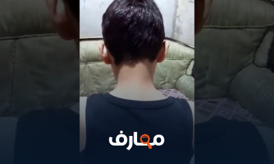 علاج دسك وغضروف الرقبة بالحجامة