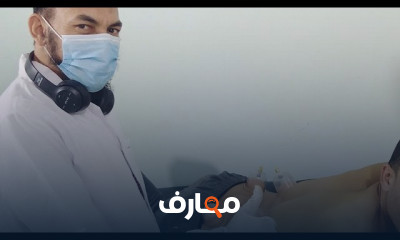 حجامة لعلاج الجيوب الأنفية