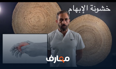تمارين لعلاج آلام مفصل اليد