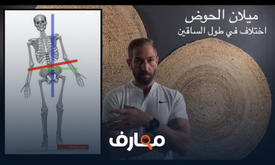 تمارين علاج إنحراف الحوض