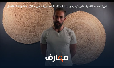 تمارين علاج خشونة المفاصل