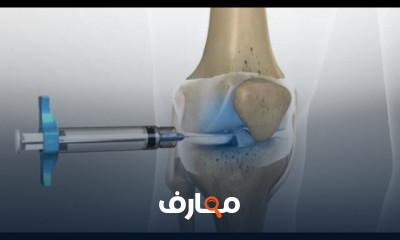 علاج خشونة الركبة بحقن الزيت