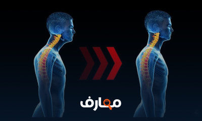 أعراض هشاشة العظام
