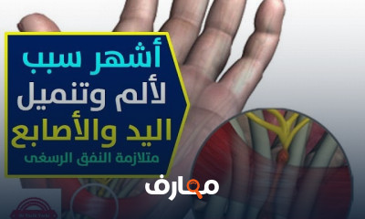 أسباب آلم وتنميل اليد والأصابع