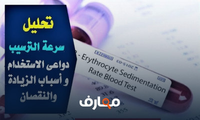 التحاليل الدورية لمريض السكري