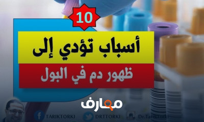علامات تحذيرية لأمراض الكلى