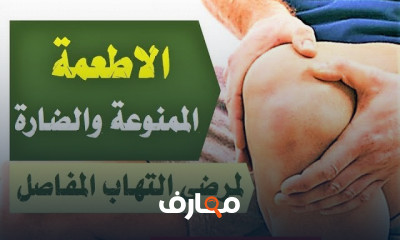 الأطعمة المناسبة لعلاج النقرس