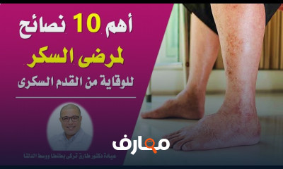 نصائح لحماية قدم مرضى السكري