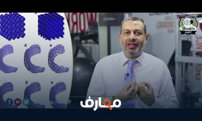 علاج تقوس العمود الفقري