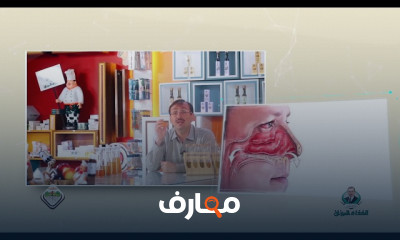 أسباب حساسية الأنف والجيوب