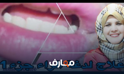 علاج لدغة حرف الراء للأطفال