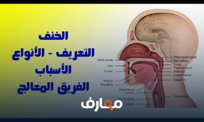 أسباب وأنواع الخنف
