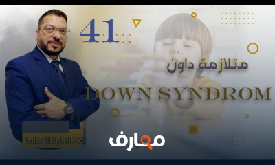 أعراض متلازمة داون وأعراضها