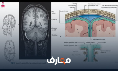 تشريح المخ والأغشية السحائية