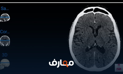 تشريح إشعاعي