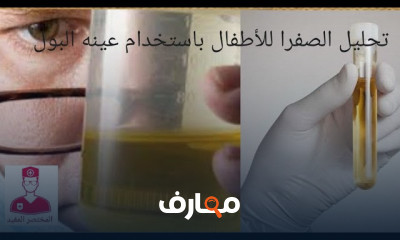 تحليل صورة الدم الكاملة CBC