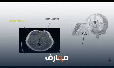 تشريح أجزاء الدماغ