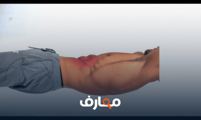 أساسيات الجمباز