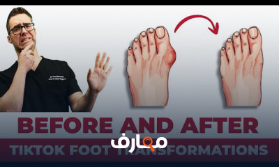 Foot Doctor Reacts