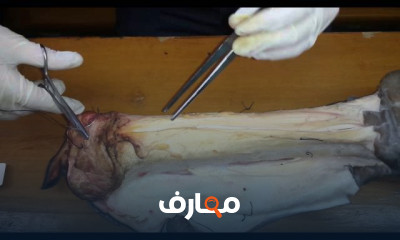 انواع الخياطة الجراحية