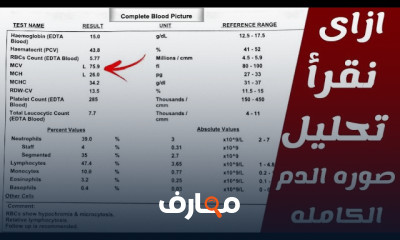 قراءة التحاليل الطبية لصيدلة
