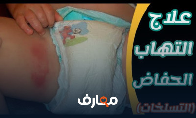 علاج الامراض الجلدية من الصيدلية