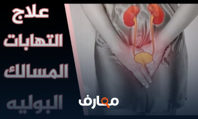 علاج التهاب المسالك البولية