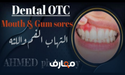طرق علاج الأسنان وامراض اللثة