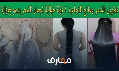 علاج دوالي الساقين والقدمين