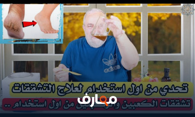 علاج تشققات القدم والكوعين
