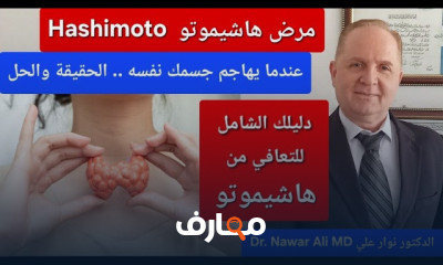 اعراض خمول الغدة الدرقية العلاج