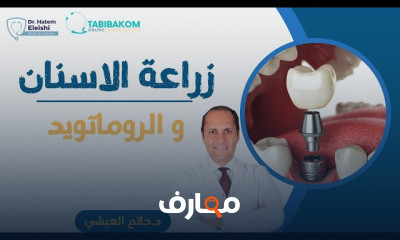 صحة الفم والاسنان لمرضى روماتويد
