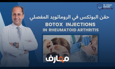 التجميل الآمن لمرضى الروماتويد