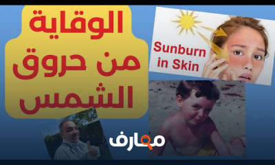 علاج مشاكل البشره في الصيف