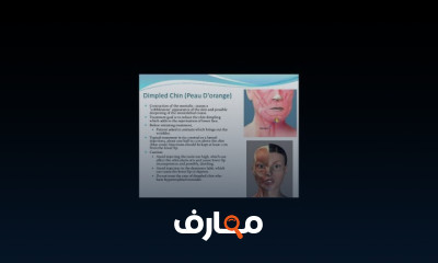 التجميل الطبي الغير جراحي 2026